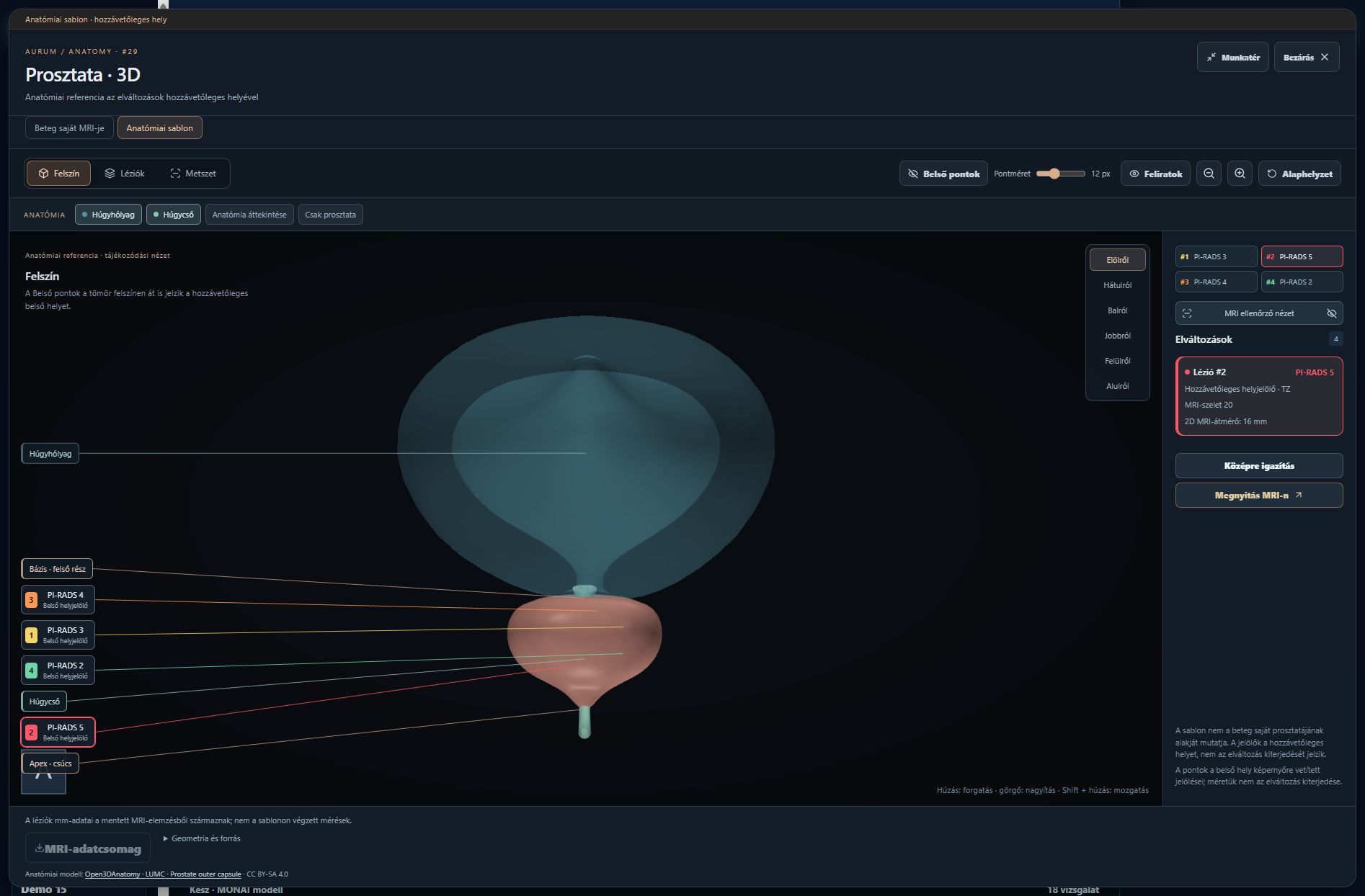 Az Aurum anatómiai 3D-nézete húgyhólyaggal, prosztatával és húgycsővel