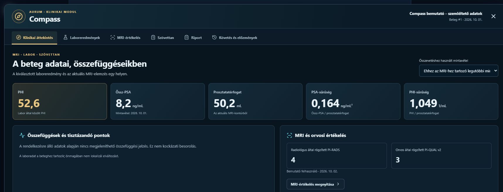 Az Aurum Compass PHI- és PSA-áttekintése szemléltető adatokkal